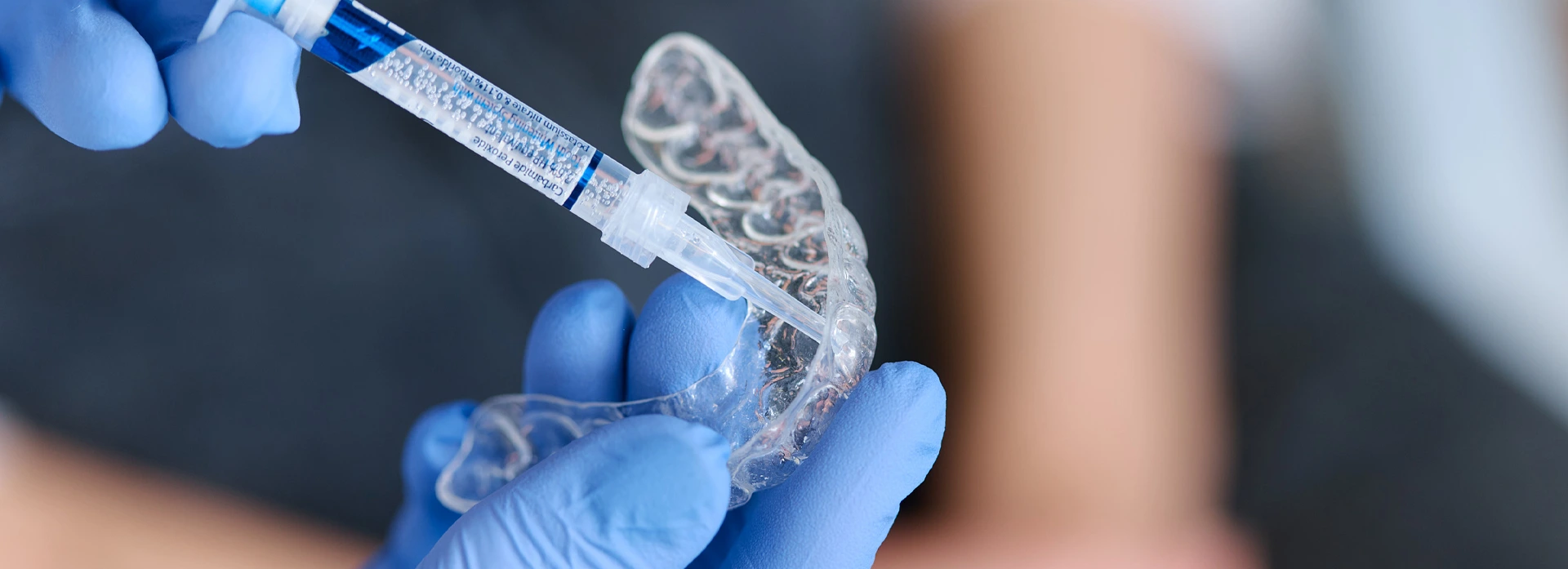 Lo sbiancamento dentale fa male? Rischi e i consigli - Stomatološka poliklinika Zagreb | Štimac centar dentalne medicine