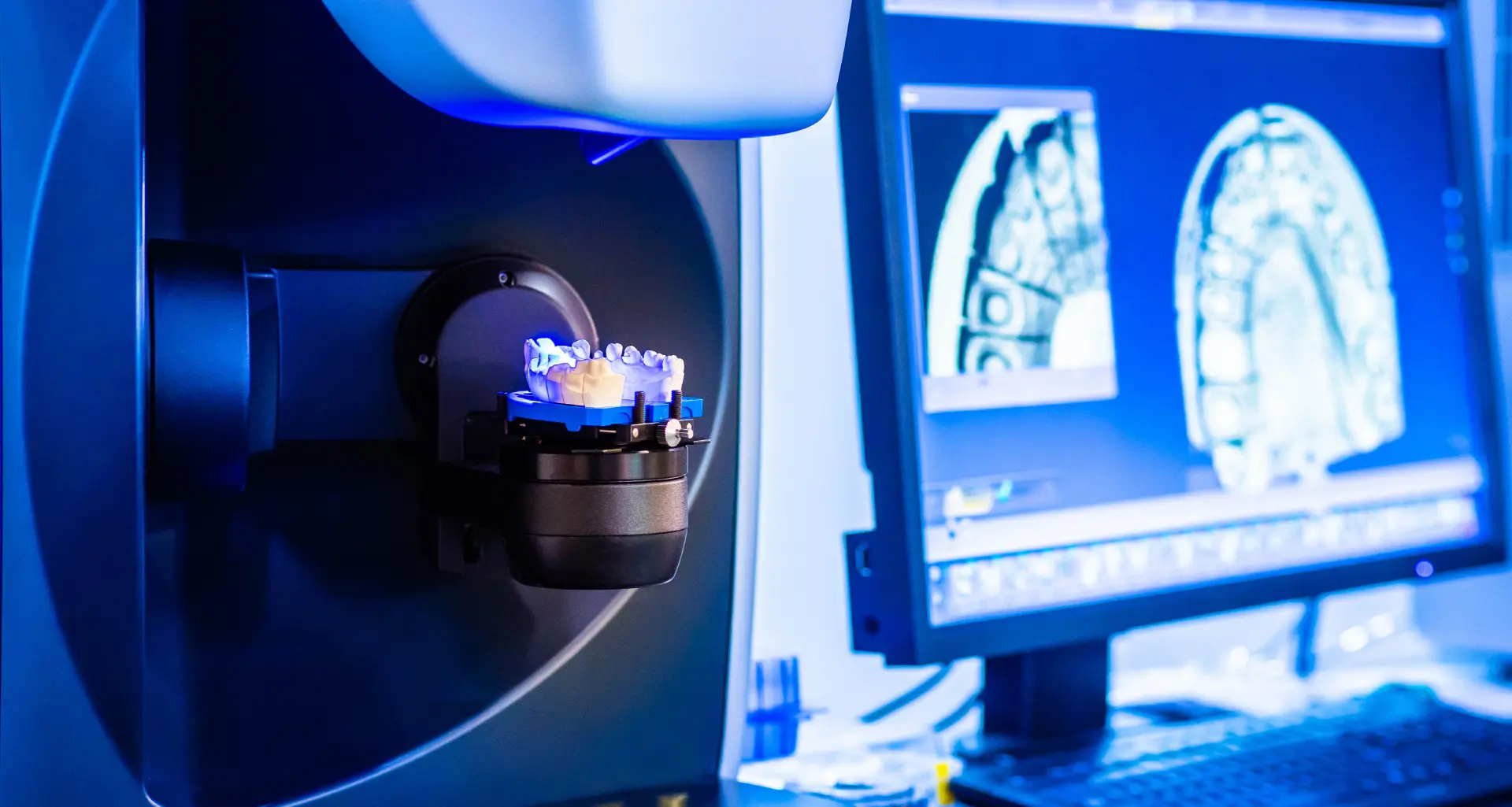 Tecnologia CAD-CAM - CAD-CAM tehnologija | Štimac centar dentalne medicine