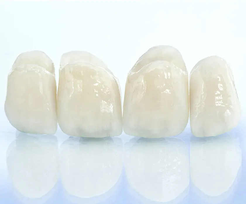 Odontoiatria protesica | ZUBNE KRUNICE