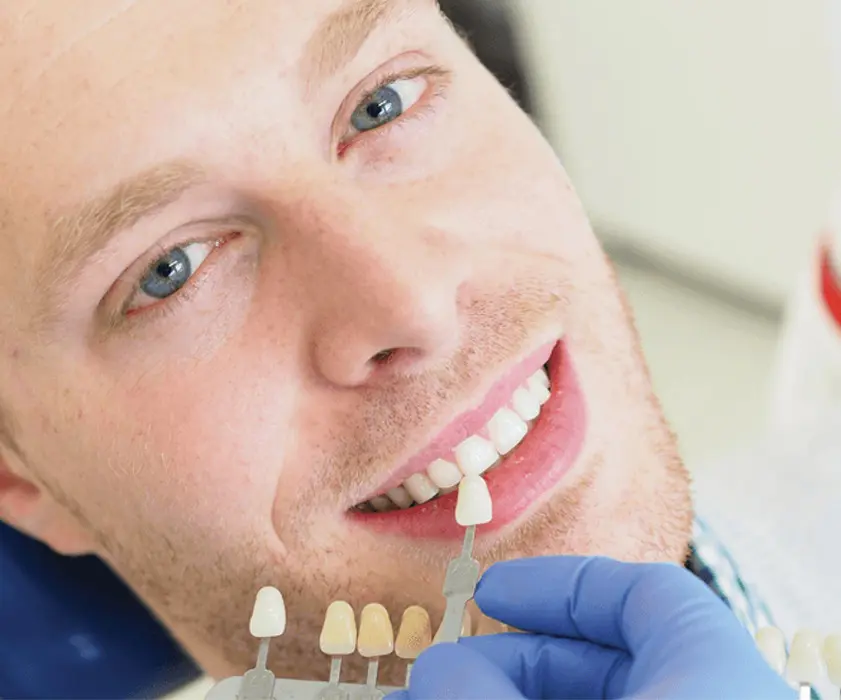 Odontoiatria protesica | LJUSKICE ZA ZUBE