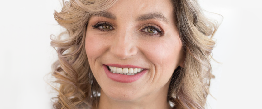 Makeover | Dental makeover | Slučaj ugradnje ljuskica i krunica