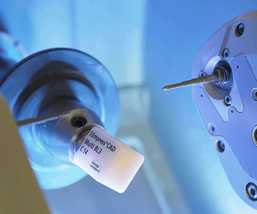 Tecnologia CAD-CAM | Centro Dentale Štimac